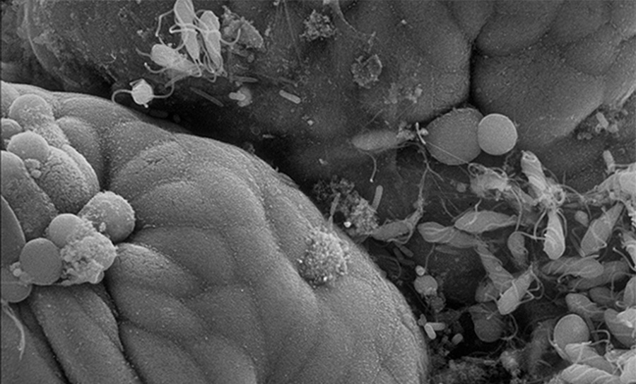 biofilm eltavolitas1