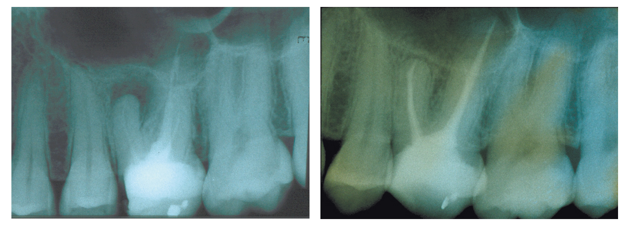 endo endovacklinik