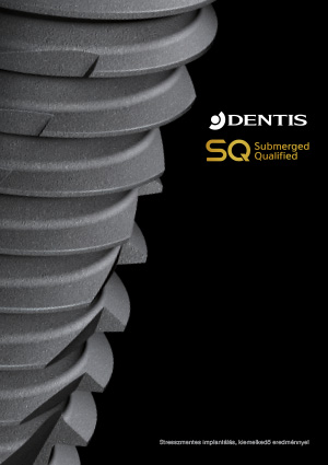 Dentis SQ katalogus