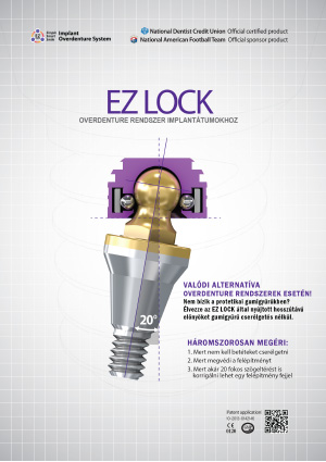 EZ LOCK katalogus